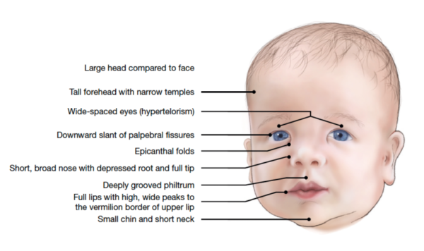 Facial Features